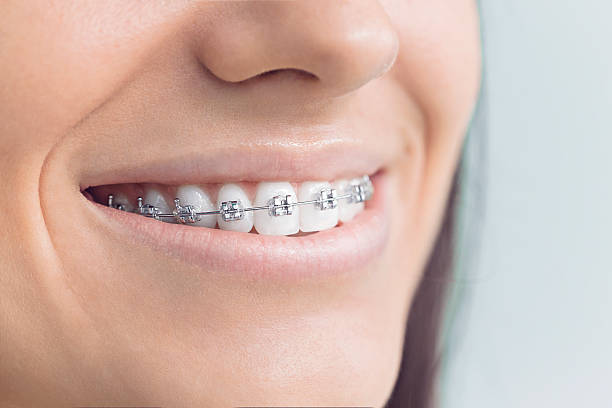 Why Choose Us for Your Dental Needs in Fairfield Plantation, GA